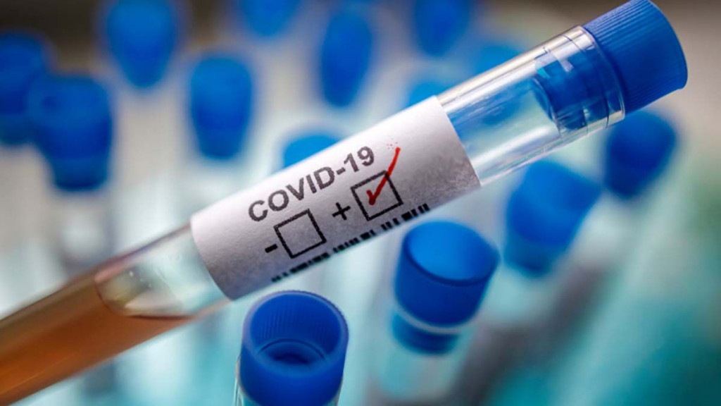 EPIDEMIJA Manje od 600 zaraženih od koronavirusa u BiH