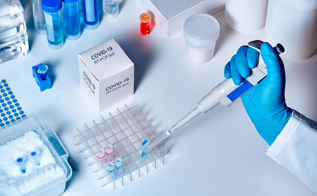 ŽZH Od danas dostupno komercijalno antigensko i serološko testiranje na koronavirus