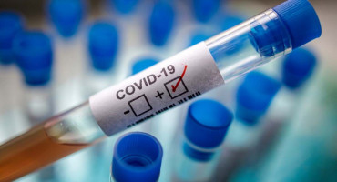 Na koronavirus pozitivno još 556 stanovnika BiH