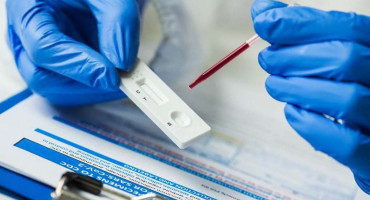 TESTIRANJA Zabilježeno 428 novih slučajeva koronavirusa u BiH