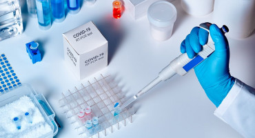 FEDERACIJA: PCR test od sutra 140 maraka