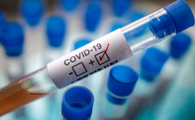 EPIDEMIJA Manje od 600 zaraženih od koronavirusa u BiH