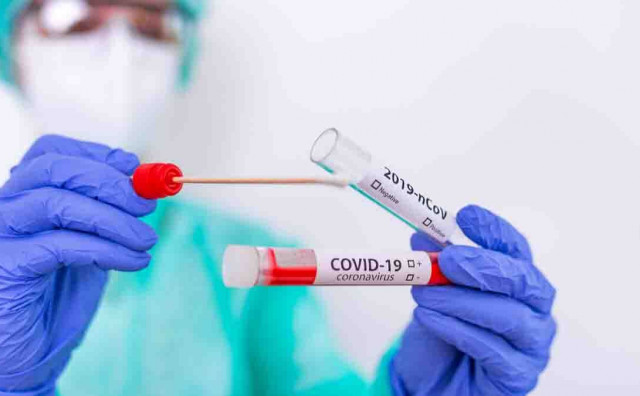 24 SATA Široki Brijeg bilježi najveći broj oporavljenih od koronavirusa u ŽZH