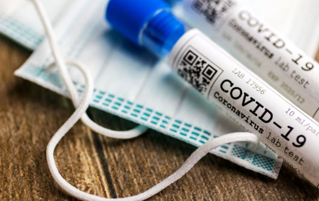 KORONAVIRUS U BIH Zabilježeno novih 1411 slučajeva zaraze