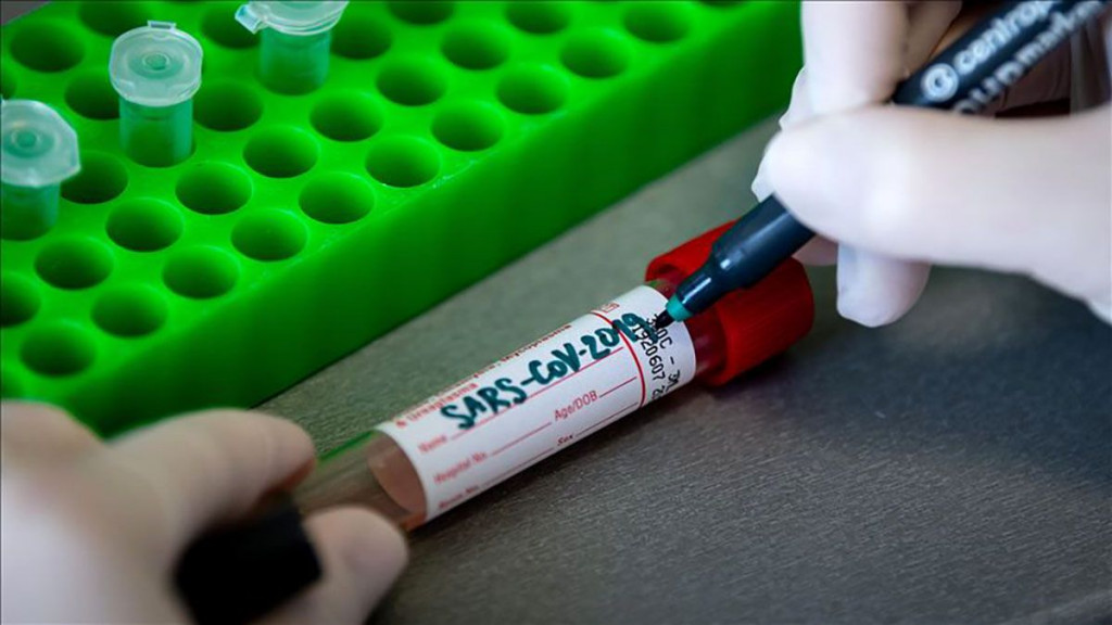KORONAVIRUS Novozaraženih 638, novi slučajevi u svim županijama