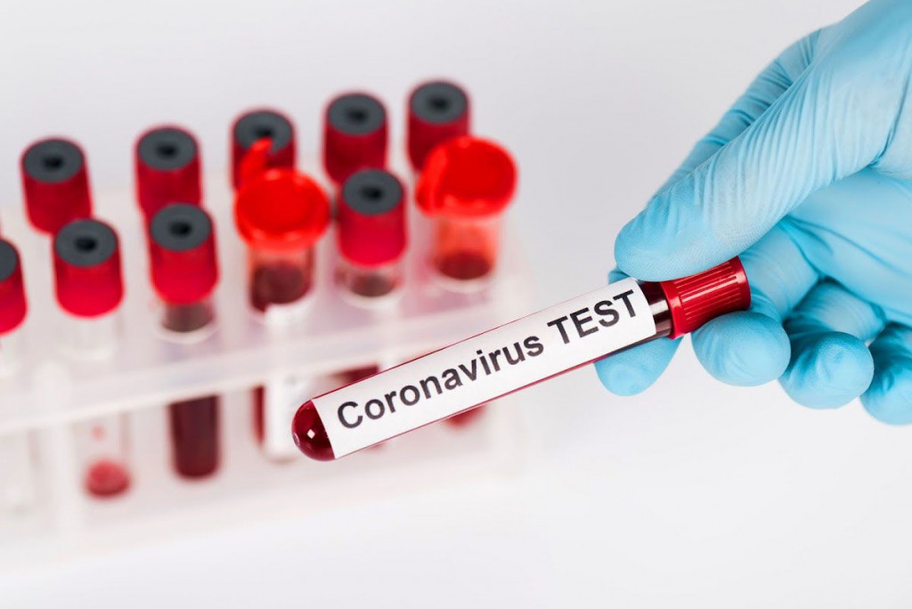 Koronavirus test