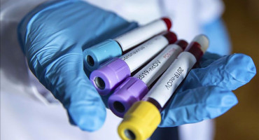 U BiH zabilježeno 736 novih slučajeva zaraze i 41 preminula osoba