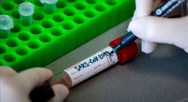 NOVI PODACI Povećava se broj zaraženih u BiH - za 24 sata 1251 zaražena osoba