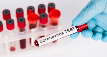 TESTIRANJA I RETESTIRANJA U ŽZH jedan novi slučaj koronavirusa
