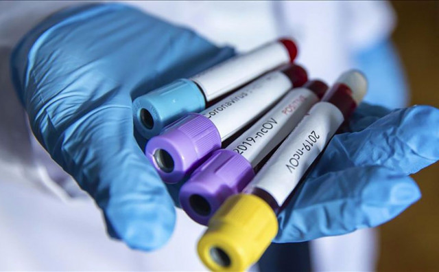 Covid 19 koronavirus