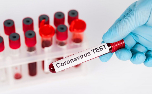TESTIRANJA I RETESTIRANJA U ŽZH jedan novi slučaj koronavirusa