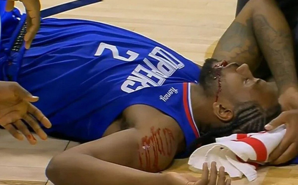 Zubac dobar u novoj pobjedi Clippersa, Ibaka nokautirao vlastitog suigrača