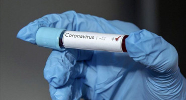 Koronavirus covid 19
