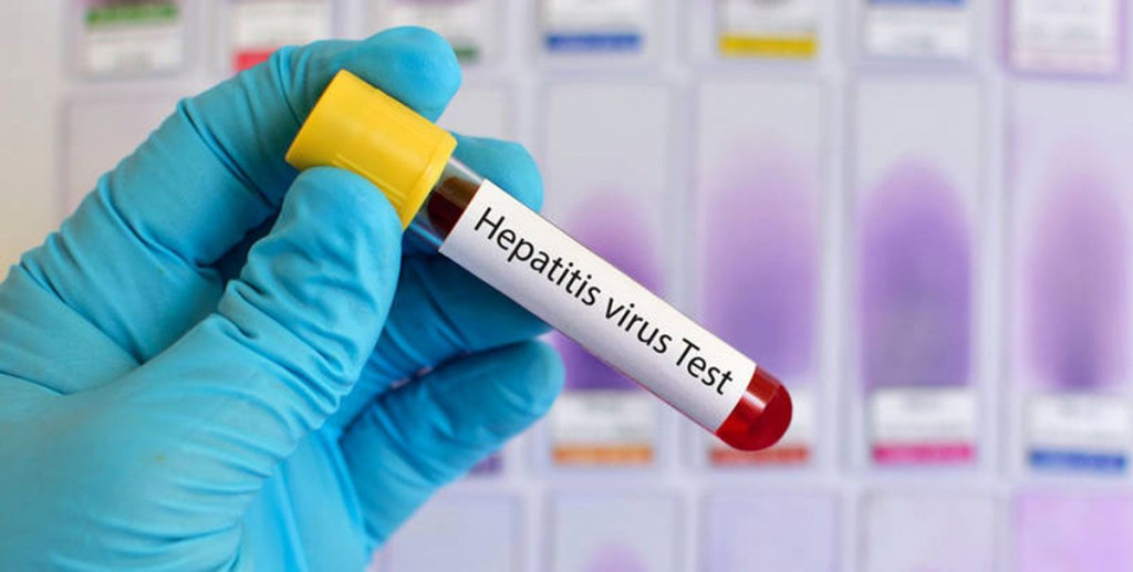 Hepatitis slusalice
