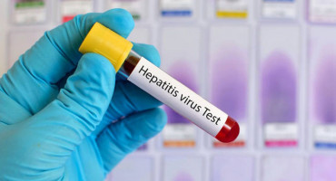 Hepatitis epruveta
