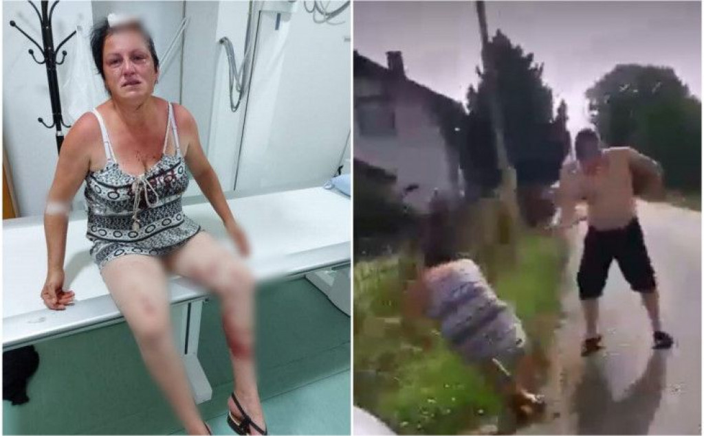 Šokantna snimka iz BiH: Metalnom šipkom tukao susjedu, a njezinog muža proganjao u Hitnoj