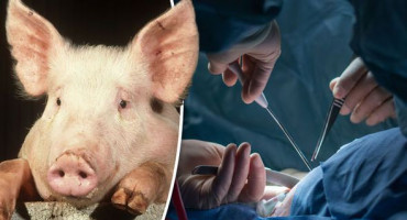 PRVI PUT U SVIJETU Čovjeku u terminalnoj fazi bolesti presađeno srce svinje