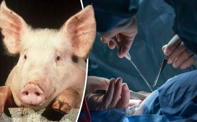PRVI PUT U SVIJETU Čovjeku u terminalnoj fazi bolesti presađeno srce svinje