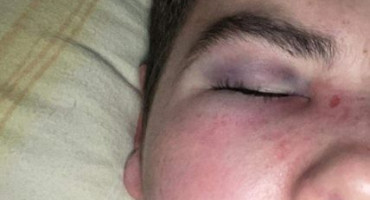 TUŽITELJSTVO SBŽ Formiran predmet protiv vlasnika kafića koji je pretukao konobara