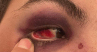 NEKOM PLAĆA I REGRES, NEKOM ŠAKA Maloljetnog Busovljaka brutalno pretukao vlasnik kafića u kojem je radio