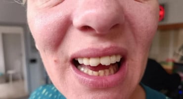 'OSJEĆALA SAM SE SILOVANO' Poznatoj hrvatskoj spikerici prilikom gastroskopije slomljena dva zuba