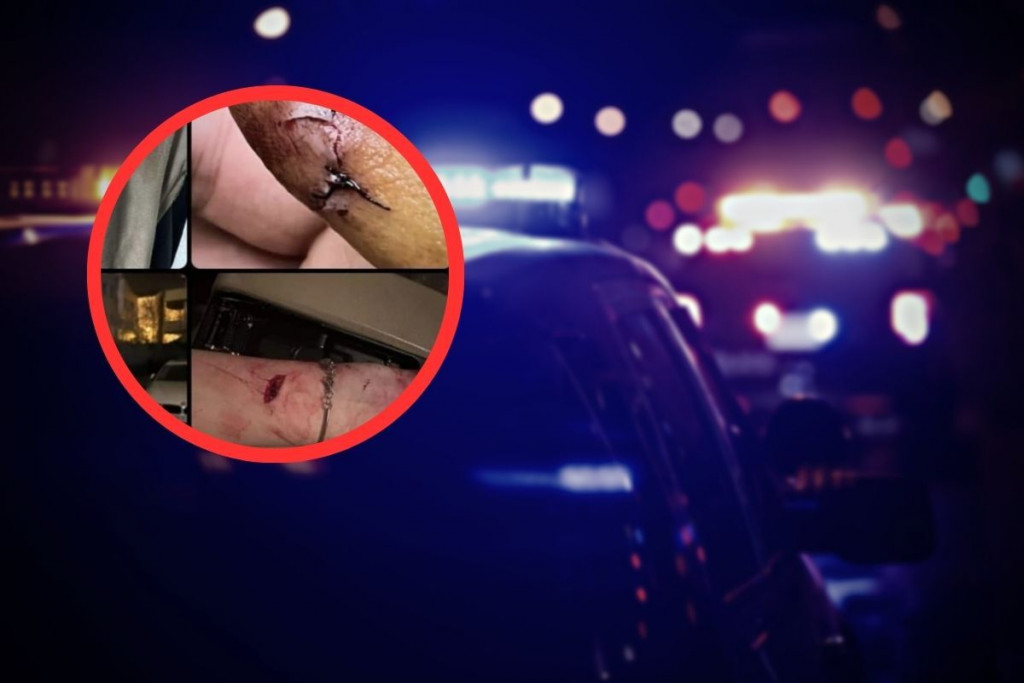 TUČNJAVA U NOĆNOM KLUBU Žene se gađale bocama i čašama, dvije osobe primljene na CUM