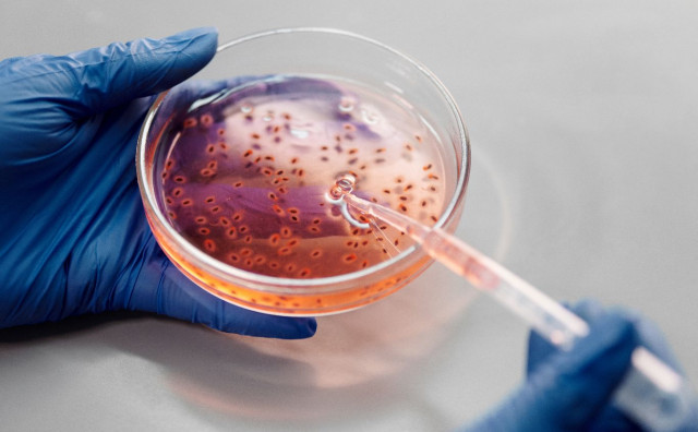 PORAST U EUROPI Sve više zaraženih opasnom bakterijom koja je otporna na antibiotike