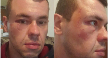 Pretučeni mladić Jablanica Konjic