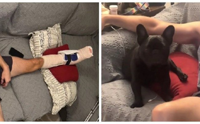 VIRALNA SNIMKA Vlasnik je ozlijedio nogu, a pas ga imitirao