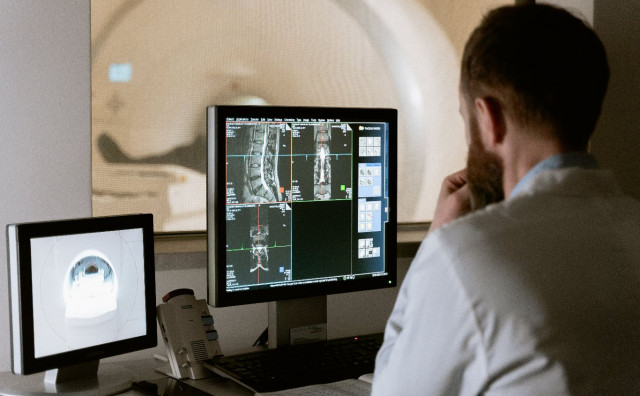 NADA ZA OBOLJELE Njemački liječnici istražuju novi postupak radioterapije za pacijente s rakom