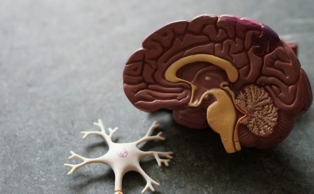 VODEĆI UZROK BOLESTI U SVIJETU Moždani udari, migrene i demencija 'preskočili' su srčane bolesti
