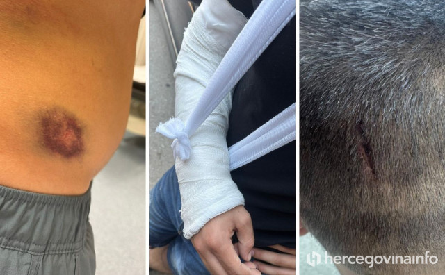 Što se događalo u Širokom Brijegu? Trojica mladića tvrde da su ih policajci brutalno pretukli na 'Gospojinu'