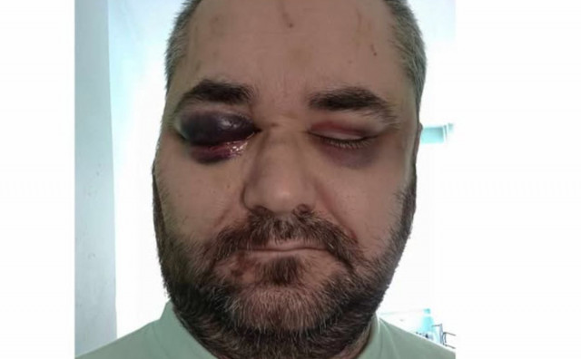 NASILNIČKO PONAŠANJE Osuđeni napadači koji su teško pretukli konjičkog novinara Isu Džinu