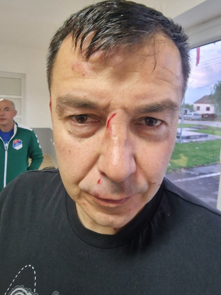 Pretučen sudac nakon utakmice