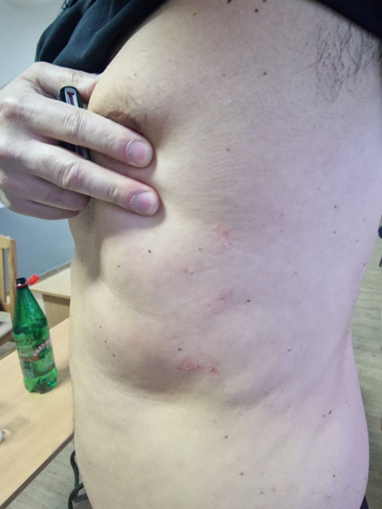 Pretučen sudac nakon utakmice