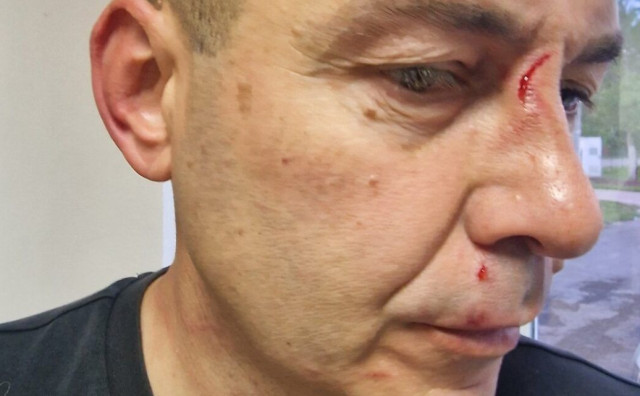 Skandal u nižoj ligi BiH: Predsjednik Borca i sin upali u svlačionicu i pretukli suca