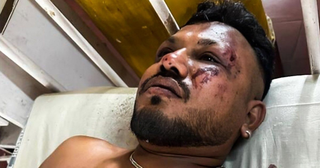 Jedini preživjeli u padu aviona u Indiji