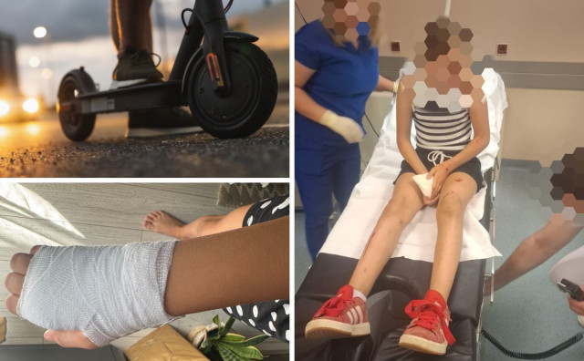 Djevojčicu u Mostaru električnim romobilom ozlijedila dvojica maloljetnika