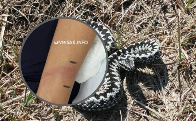 Ženu kod Širokog Brijega ugrizao poskok, upućena na liječenje u Mostar