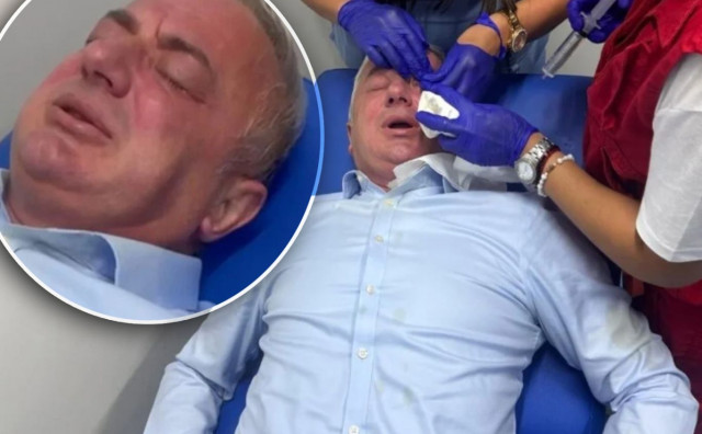 Branislav Borenović objavio snimku napada ispred zgrade u kojoj živi