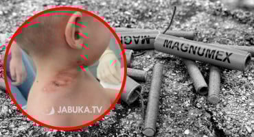 dječak petarda ozljede