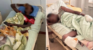 Sudancima amputirane noge i ruke