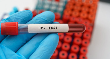 Testiranje na HPV virus