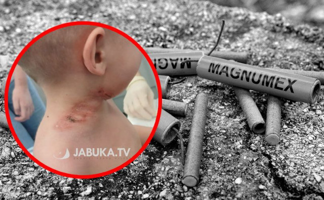 Trogodišnji dječak ozlijeđen petardom kod Širokog Brijega