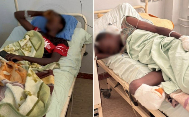 Trojici Sudanaca amputirane noge, dvojici i ruke nakon smrzavanja na Plješevici