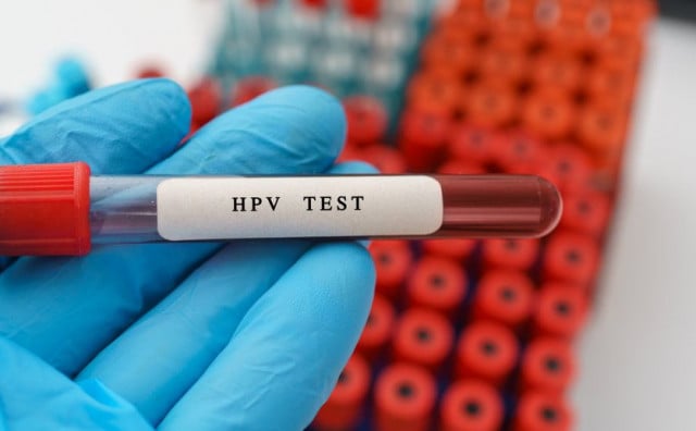 Testiranje na HPV virus