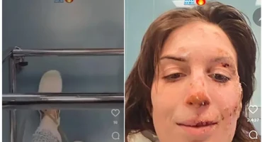 Požar u Švicarskoj