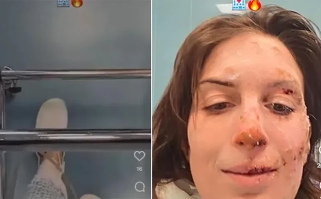 Djevojka opisala kako je preživjela požar u švicarskom baru smrti