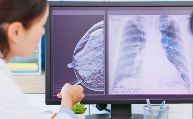 Svjetska zdravstvena organizacija: Ove navike su glavni krivci za većinu karcinoma