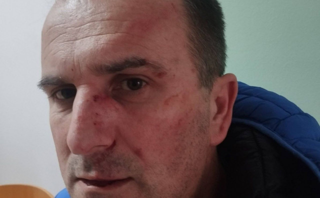 Razotkrio aferu vezanu uz vrtić u BiH, pa brutalno pretučen